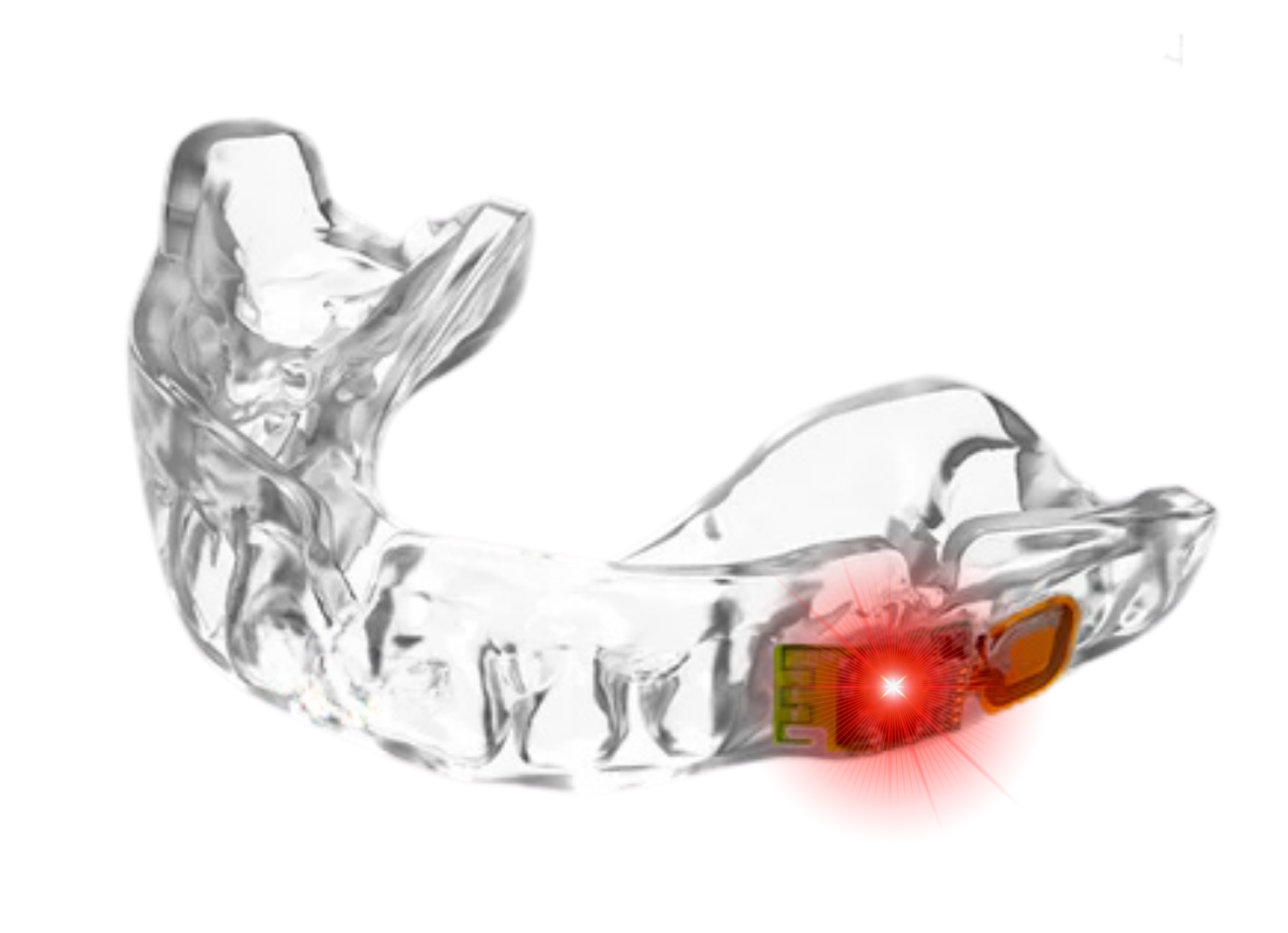 Custom Pro Smart Mouthguard