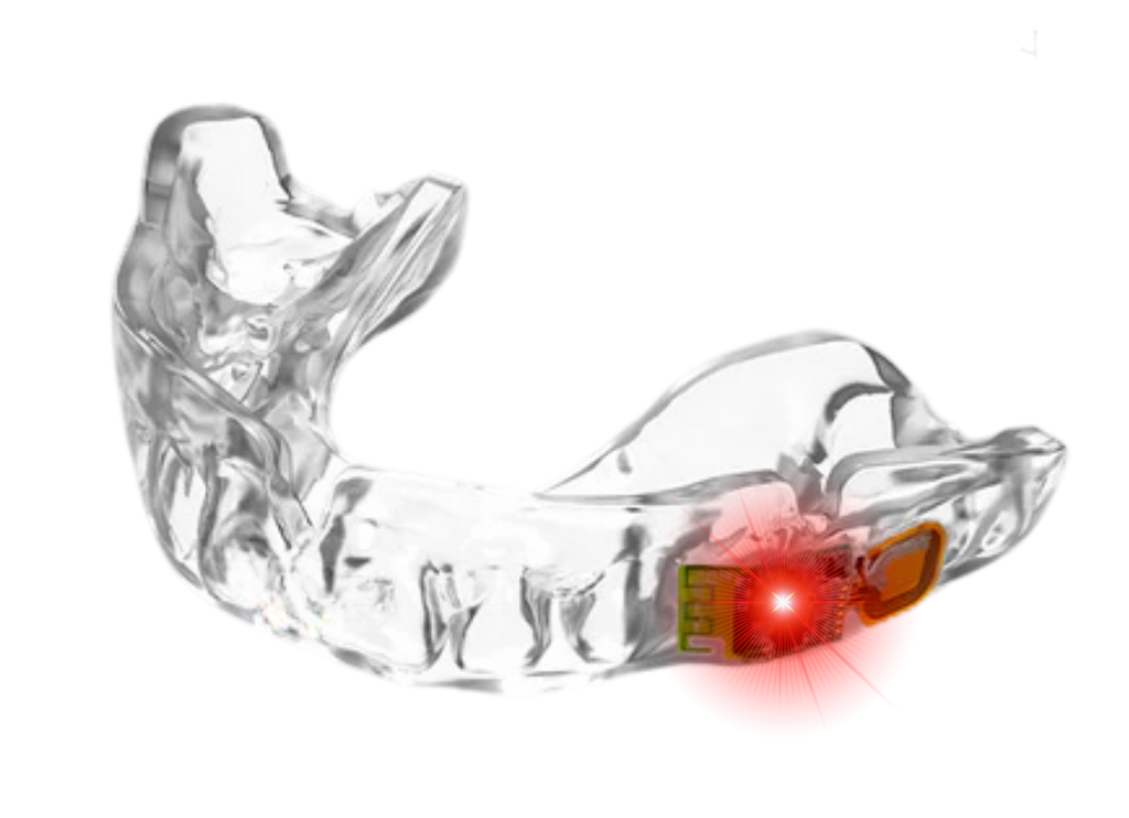 Custom Pro Smart Mouthguard